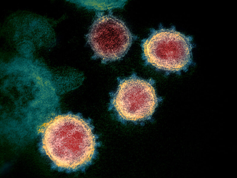 Coronavirus: La Ciencia En Resumen – Science In School