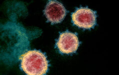 New SARS-CoV-2 virus particles emerging from laboratory cultured cells.