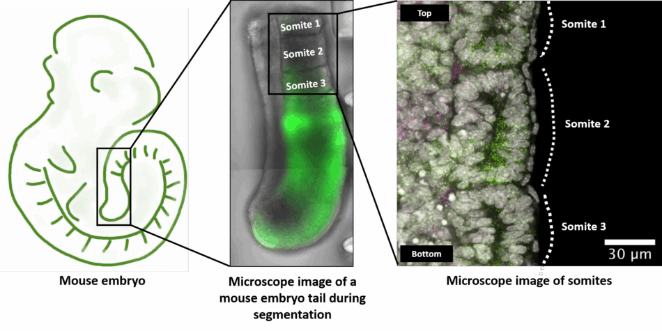 A three-panel graphic. The first panel shows a schematic drawing of a mouse embryo with a boxed region highlighting the tail. The second panel is a microscopy image of the tail, appearing as a rod-like structure divided into vertical segments, with the first three labeled Somite 1, Somite 2, and Somite 3. The third panel is a higher-magnification microscopy image of these somites, showing distinct segmentation between them.